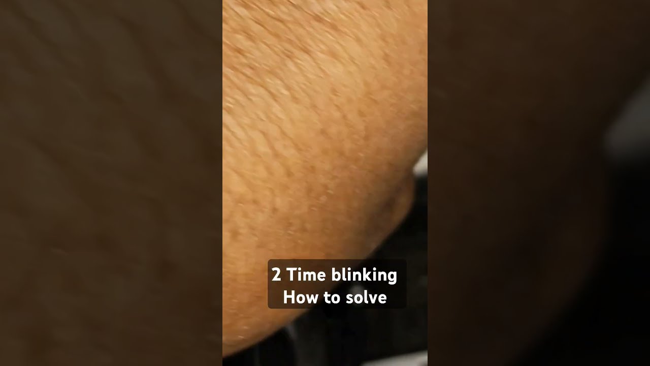 Canon G2730 2 Time Blinking How To Solve