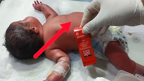 Critical Newborn Case | Abdominal Distension & Micronemia Management | NICU Nursing Education video