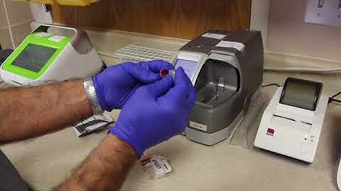 HB A1C - Training Video