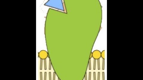 Plazomicin Overview_Dr Pradeep Rangappa