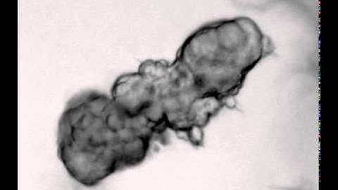 Addition (22 Hr) and Washout (69 Hr of Culture; 45 Hr into the Movie) of ROCK Inhibitor