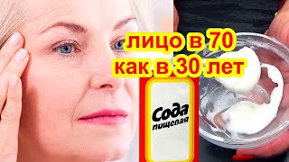 ✔СИЛЬНЕЙШЕЕ ОТ МОРЩИН И ПЯТЕН ! НАНОСИТЕ КАЖДЫЙ ДЕНЬ СОДУ ОТ МОРЩИН Натуральный рецепт