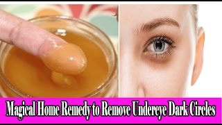 आँखों के नीचे के काले घेरों को कैसे दूर करें | Magical Home Remedy To Remove Under eye Dark Circles