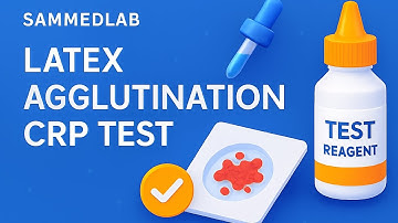CRP Test Using Latex Agglutination | SAMMEDLAB Medical Tutorial---