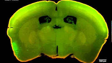 Mouse brain after 64 days in clearing solution