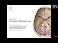 Matthew L. Carlson, MD: Rethinking Vestibular Schwannoma