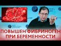 Фибриноген повышен или понижен при беременности: насколько это опасно и что делать