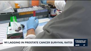 Wisconsin lagging behind prostate cancer survival rates