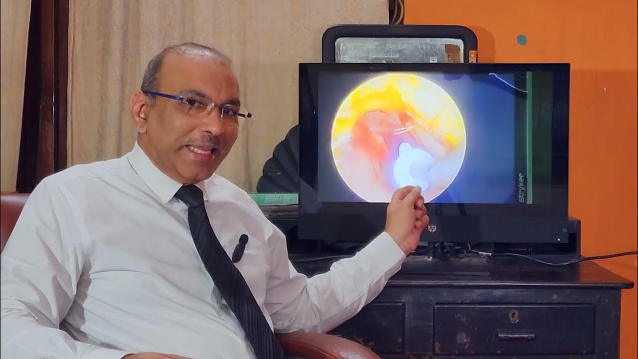 Myringotomy with grommet insertion / Patient teaching programme / English YouTube