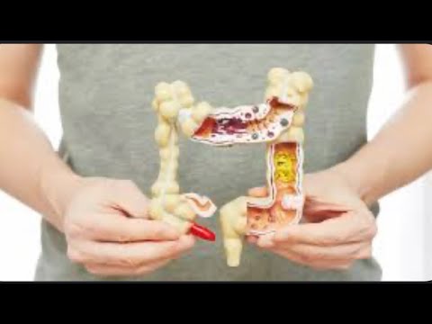 من الأسباب الخفية للإمساك