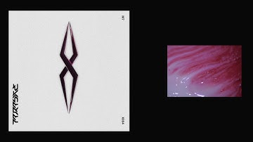 [X004] M7 - Onyx (Oprofessionell 