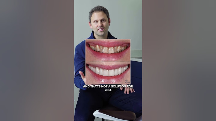 3 Main Reasons People Get Porcelain Veneers