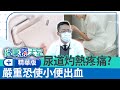 尿道炎「5症狀」嚴重恐出血！　男女「親密行為」易提升發炎機率《健康療天室精華篇》| 泌尿科 程威銘醫師 @ChinaTimes