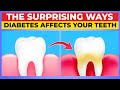 The Surprising Ways Diabetes Affects Your Teeth