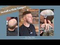 How to install a skin toupee mens hair system before and after  new times hair