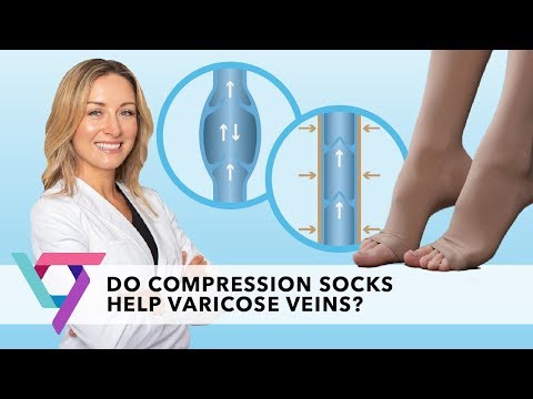 Do Compression Stockings Help to Treat Varicose Veins?