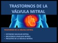 Trastornos de la válvula mitral - Fisiopatología