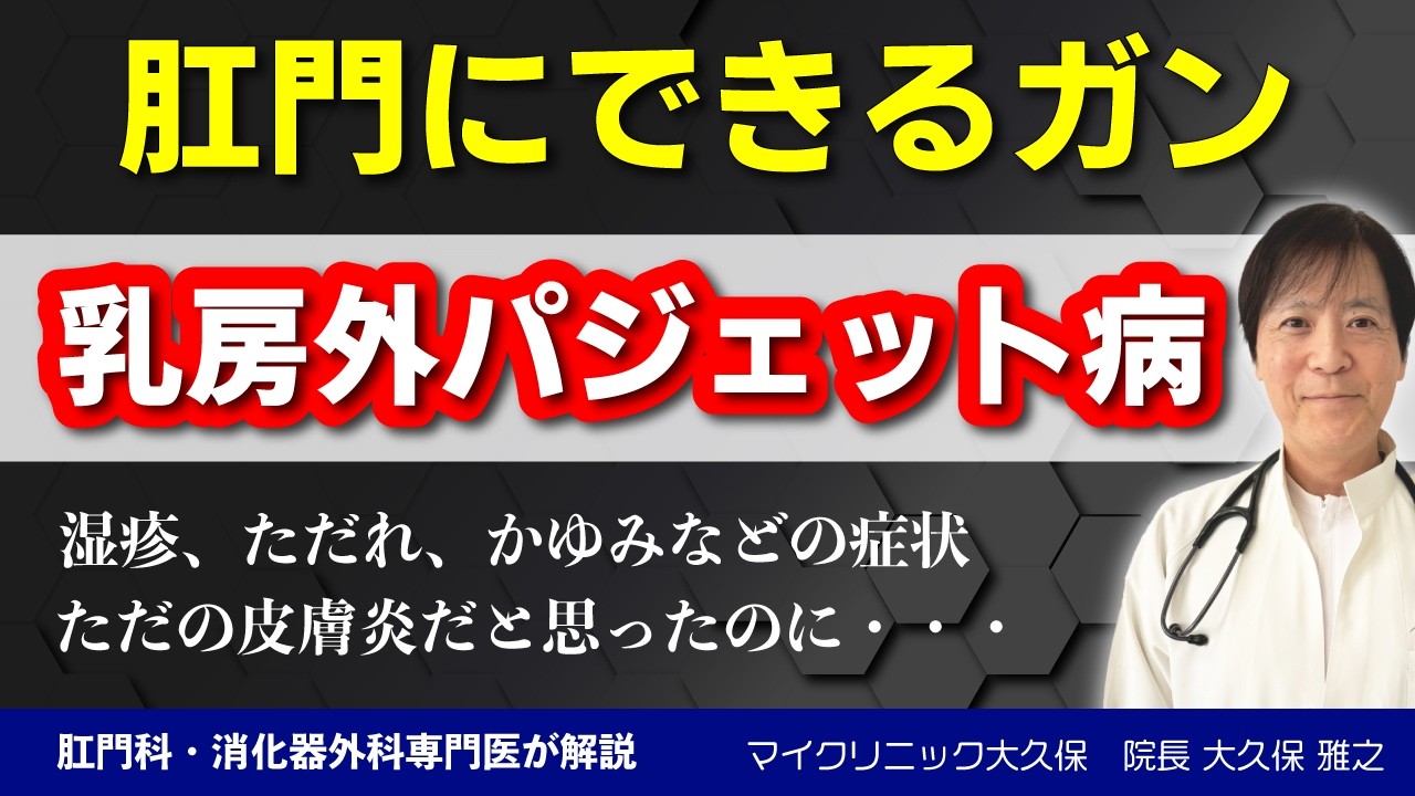 肛門にできる稀な皮膚がん「乳房外パジェット病」を専門医が詳しく解説|皮膚炎と間違われる癌