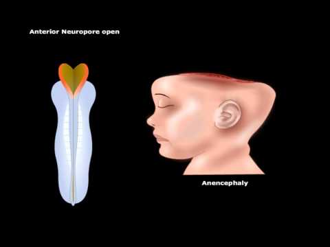 USMLE® مرحلہ 1: نیورو سائنس: سی این ایس اینیمیشن کی ترقی