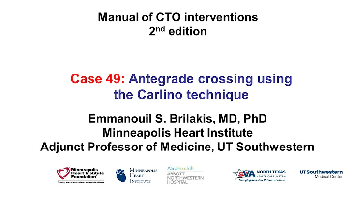 Case 49: Manual of CTO Interventions - Carlino