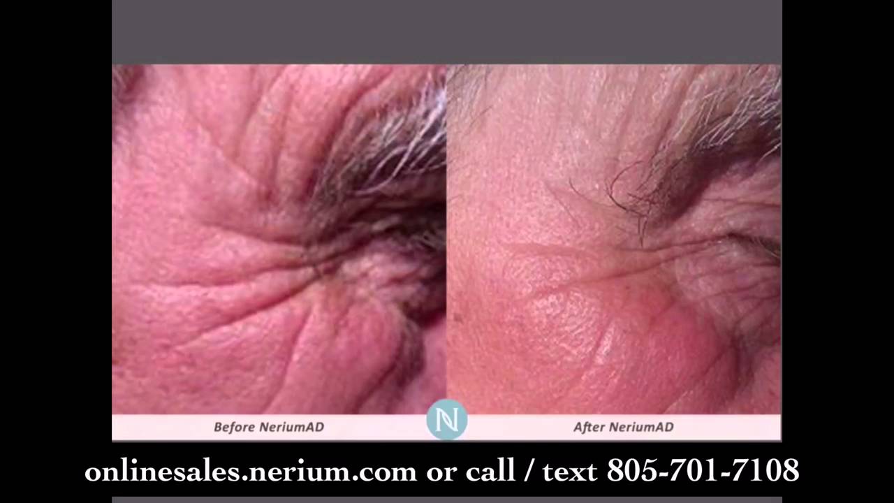 Early Signs of Liver Problems m Early Signs of Liver Problems m