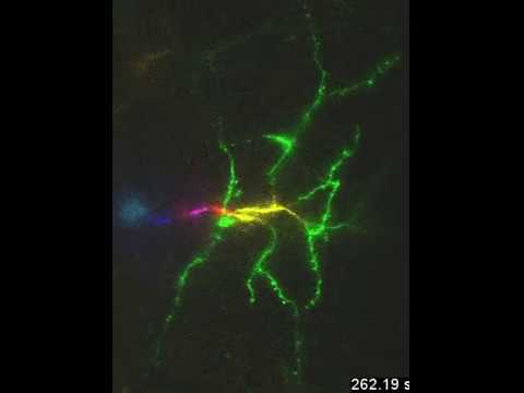 Watch a neuron fire!
