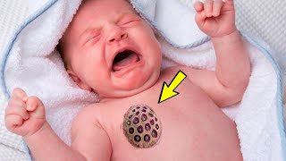 На теле младенца появилось странное пятно, врач сразу же вызвал полицию!