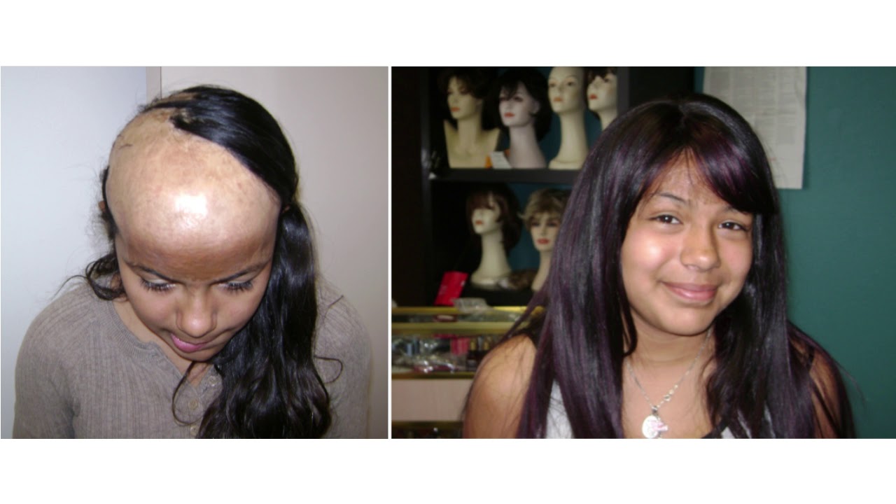 Alliance Healthcare Foundation Mission Support Grant 2019