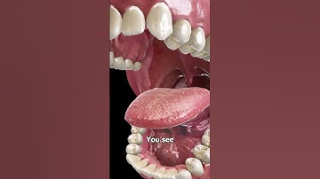 Thumbnail of Why Dipping Fries In A Wendy's Frosty Taste SO Good 😯