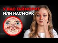 Как Распознать Гаморит: Причины, Симптомы, Лечение