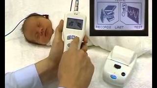 Prueba de Emisiones Otoacústisticas Transitorias en segundos en recién nacidos