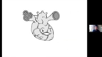 Kyle Hayden: Where are the complex curves in Khovanov homology?