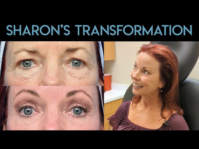 Sharon's Transformation