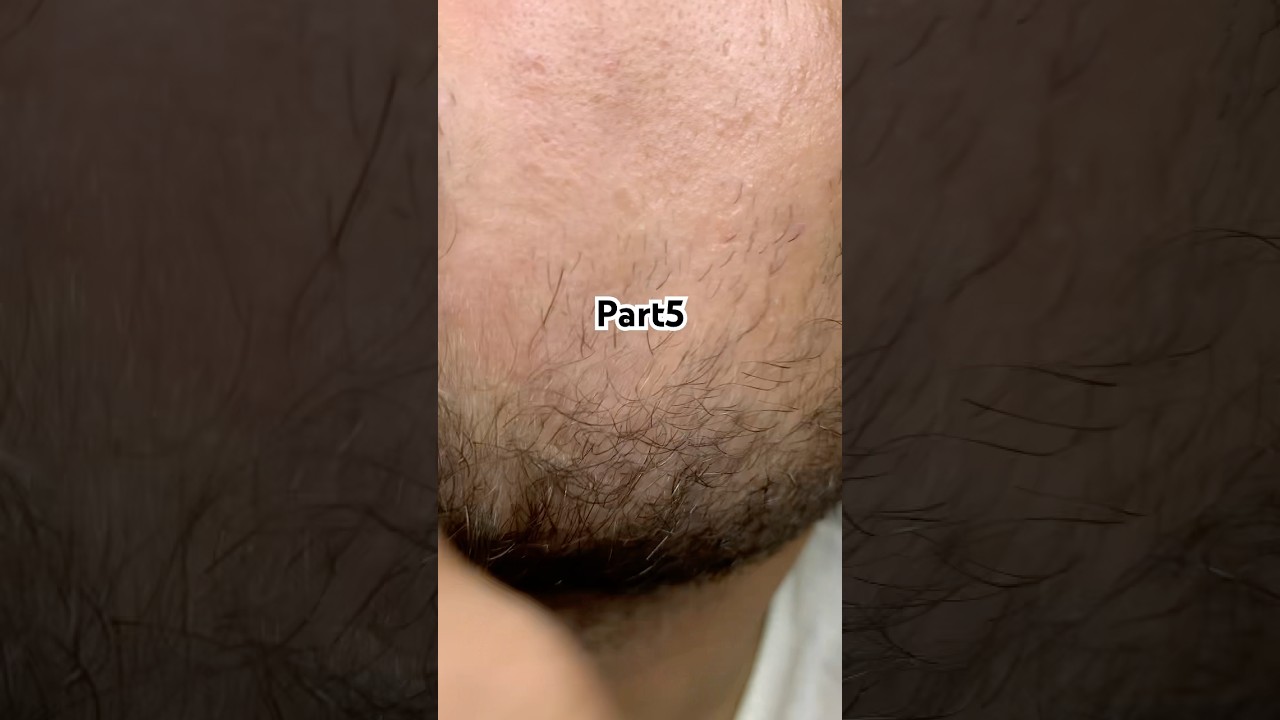 the first thing hair looks 🤔