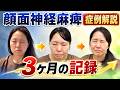 【顔面神経麻痺】3ヶ月治療経過の症例仮説|ラムゼンハント症候群
