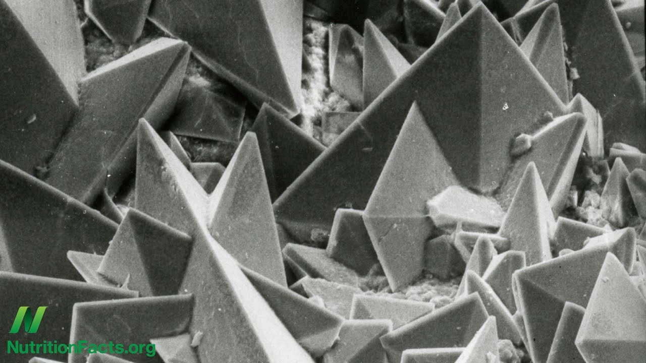 How to Prevent Kidney Stones With Diet YouTube