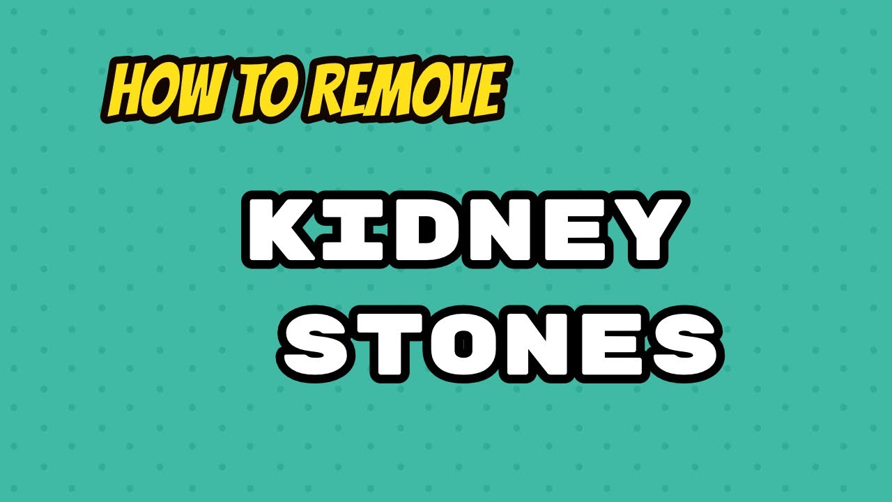 How To Remove Kidney Stones YouTube
