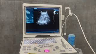Mindray DP-50 Ultrasound Machine