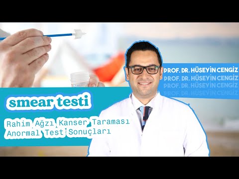 SMEAR TESTİ 🔔   SONUCU YORUMLAMA (smear testi pozitif ➕  çıkarsa)