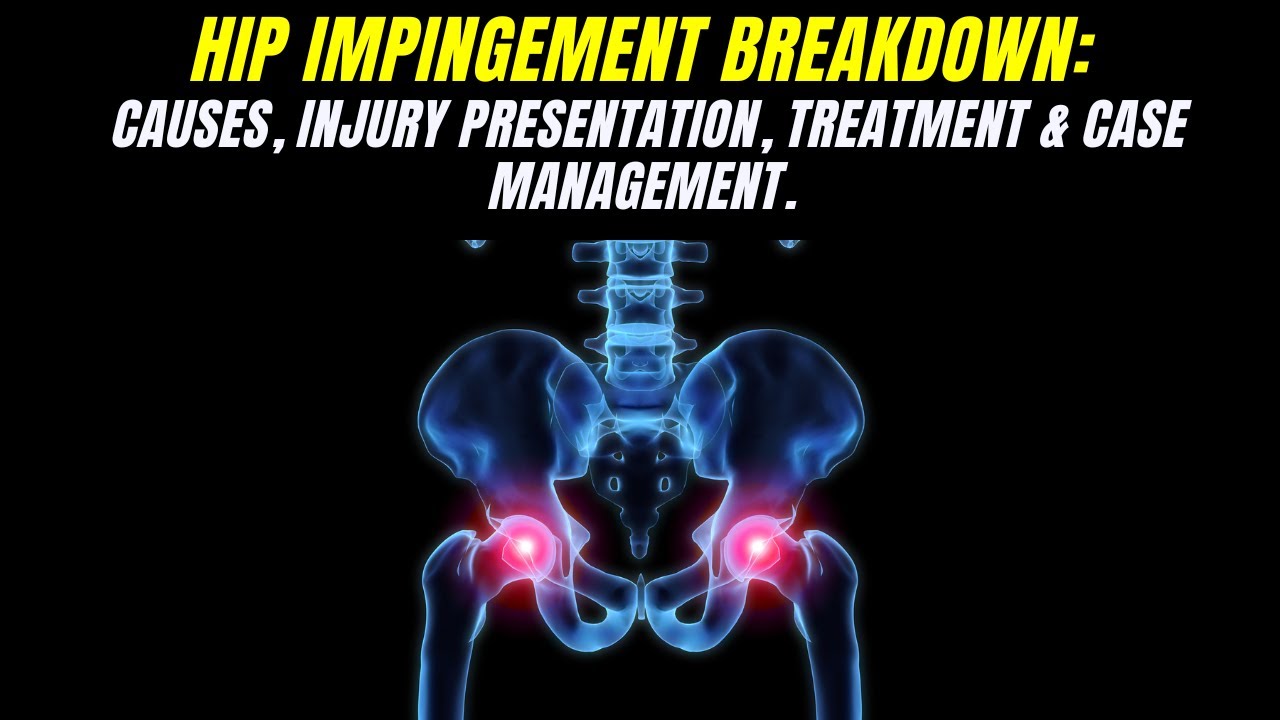 Hip Impingement Breakdown: Why It Isn"t A Hip Flexor Problem!