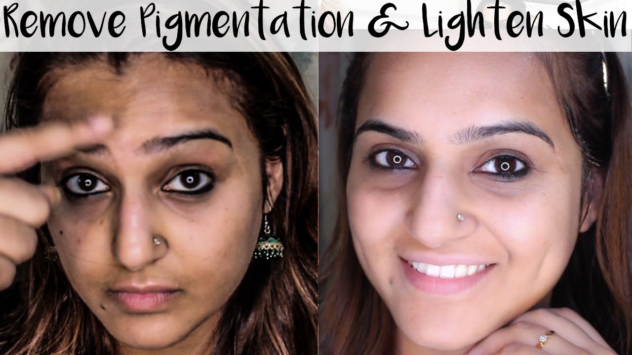 How to Get Rid Pigmentation, Dark Spots, Discoloration Lighten Skin At Home - YouTube