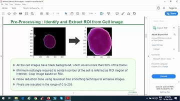 Machine Learning Based System for Automatic Detection of Leukemia Cancer Cell