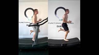 Acl Rehab Gait Beforeafter. Luke Part 2.