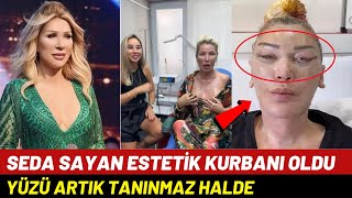 Estetik Yüzünden Tanınmaz Hale Gelen Ünlüler | Seda Sayan'ın son Hali