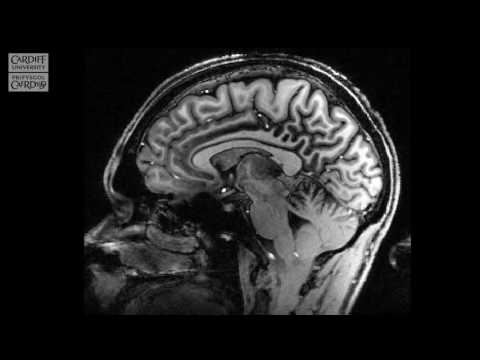 Sganiwr 7T MRI - Canolfan Ymchwil Delweddu'r Ymennydd Prifysgol Caerdydd