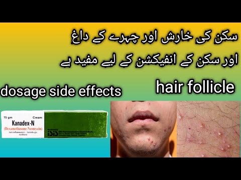 kanadex n cream used for face/kanadex n cream used for in urdu - YouTube