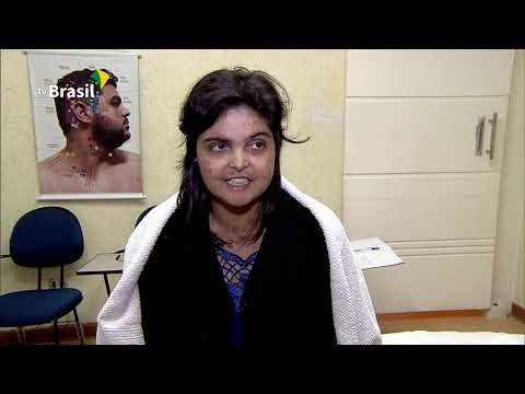 Tratamentos trazem bem-estar aos pacientes com lúpus, que não tem cura