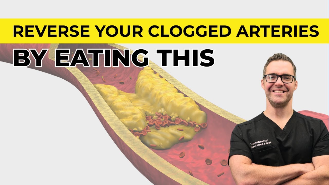 What Foods Can Help With Blood Flow Vitamin K2 Benefits YouTube What foods can help with blood flow vitamin k2 benefits youtube