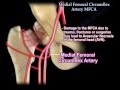 Medial Femoral Circumflex Artery - Everything You Need To Know - Dr. Nabil Ebraheim