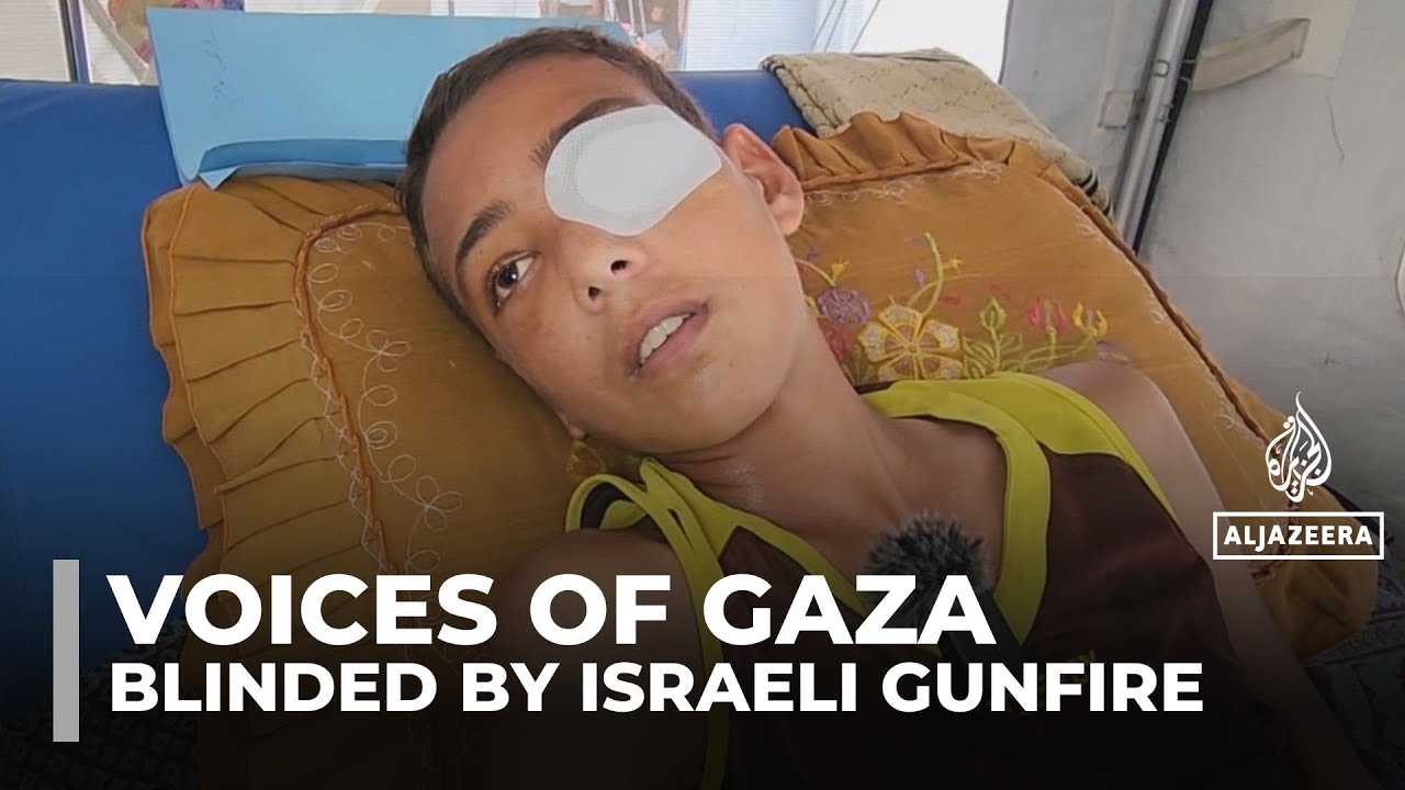 مراهق فلسطيني يفقد بصره في إحدى عينيه بعد إطلاق النار عليه أثناء بحثه عن الطعام في مركز إغاثة في غزة